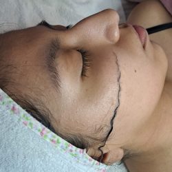 Limpieza facial